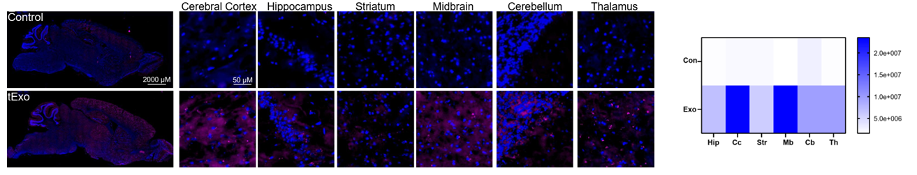 The delivery system distributes across multiple brain regions